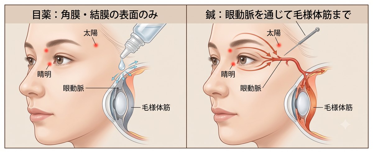 左：目薬は角膜・結膜の表面のみ。右：鍼は眼動脈を通じて毛様体筋まで血流を届ける