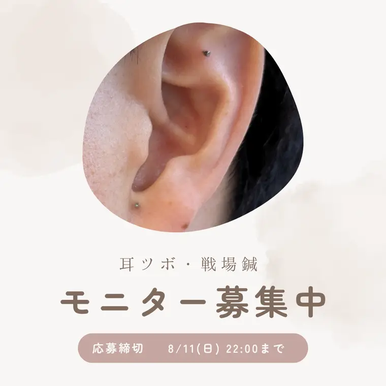 【終了しました】耳ツボ療法・戦場鍼モニター募集開始！ストレス緩和と自律神経の調整を体験しませんか？