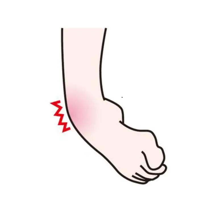 捻挫