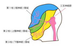 https://www.saiseikai.or.jp/medical/disease/trigeminal_neuralgia/