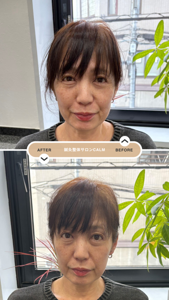 モニター B 様 の before / after
