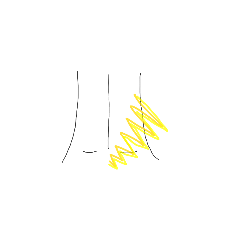 しびれ