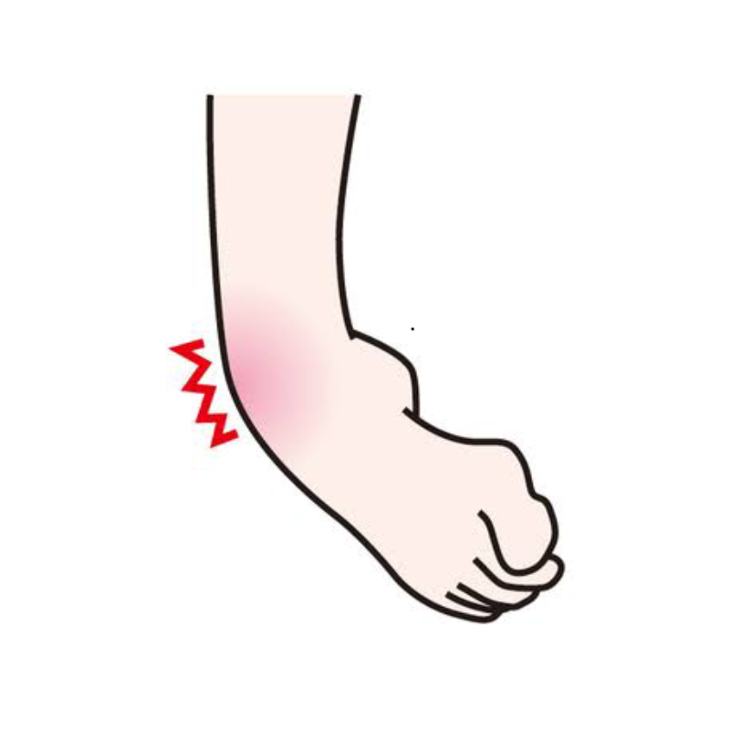 捻挫