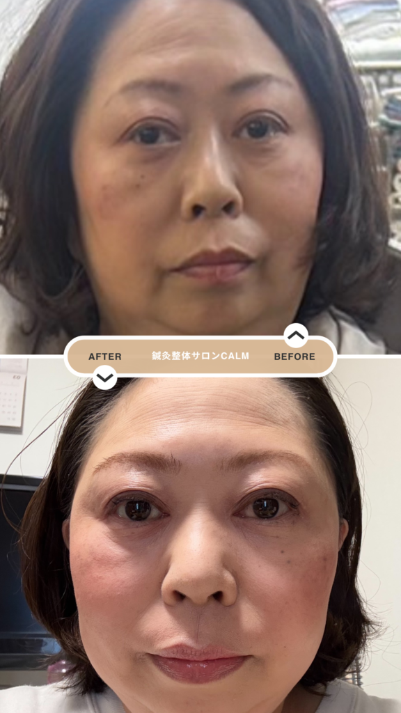 モニター A 様 の before / after